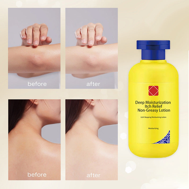 đ„Deep Moisturization Itch Relief Non-Greasy Lotion