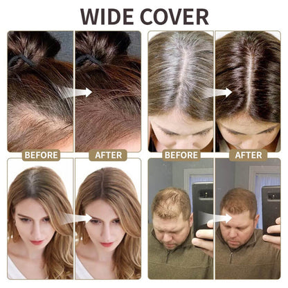 💖2025 New Upgraded Magic Root Cover Up✨