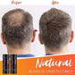🔥 BIG SALE -49% OFF🔥 - Fluffup secret hair fiber powder-Effective hair supplement